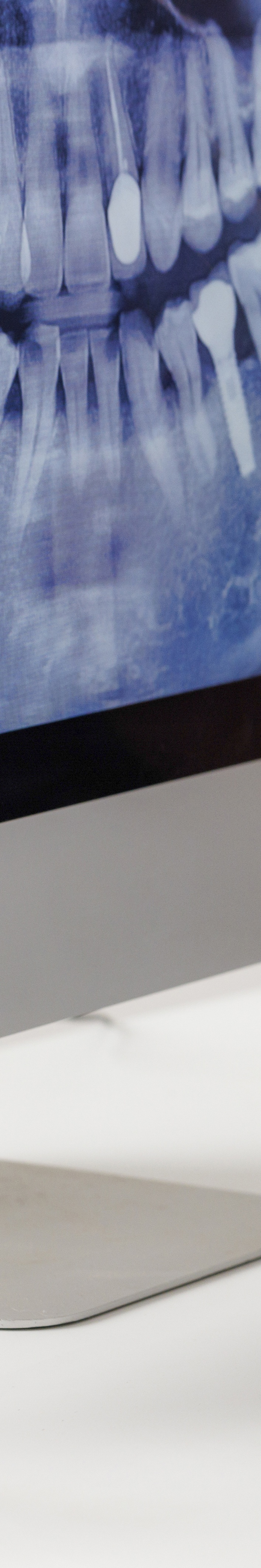 압구정 전체임플란트비용 선택 기준 7가지 살펴보기 관련 이미지 18