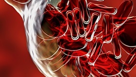 성인 혈압정상수치 범위 벗어나기 관련 이미지 20