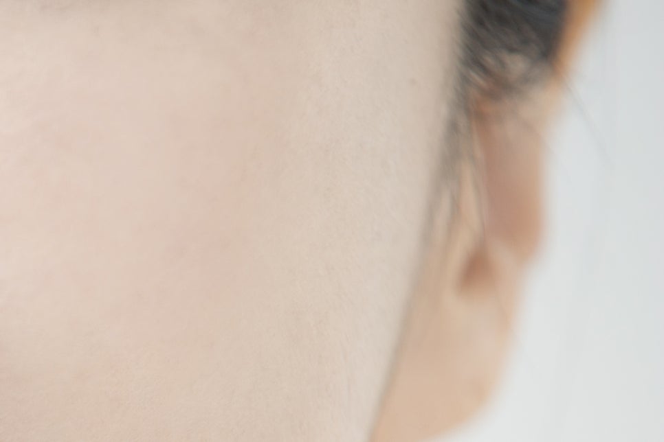 학동사거리 치과 무치악 임플란트 고민이라면 관련 이미지 20