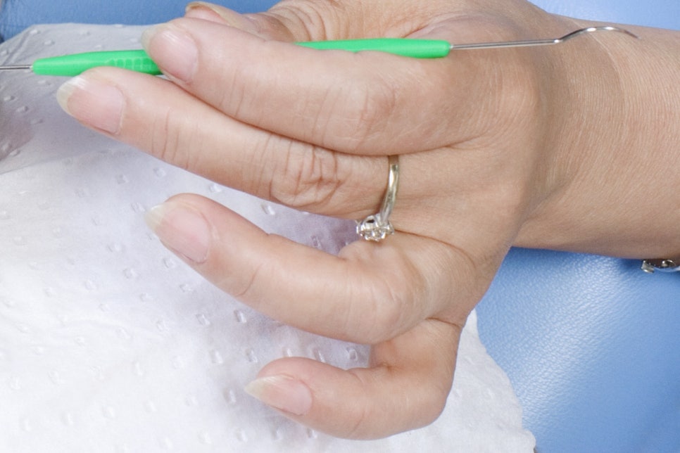 풀아치임플란트 불편한 틀니와 작별해요! 관련 이미지 26