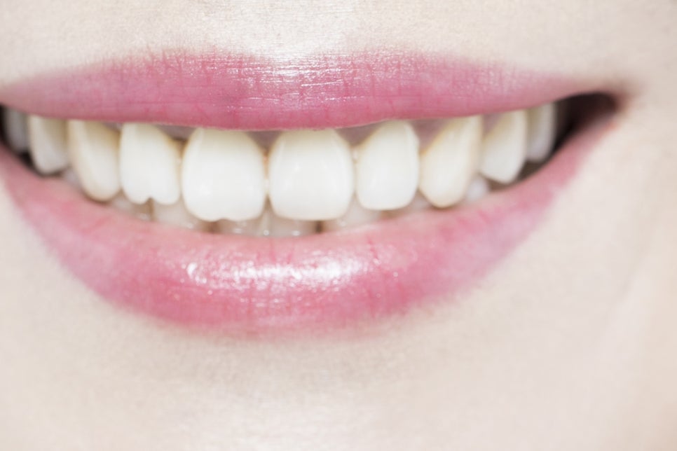 강남 65세이상임플란트 이것만 참고하자! 관련 이미지 22