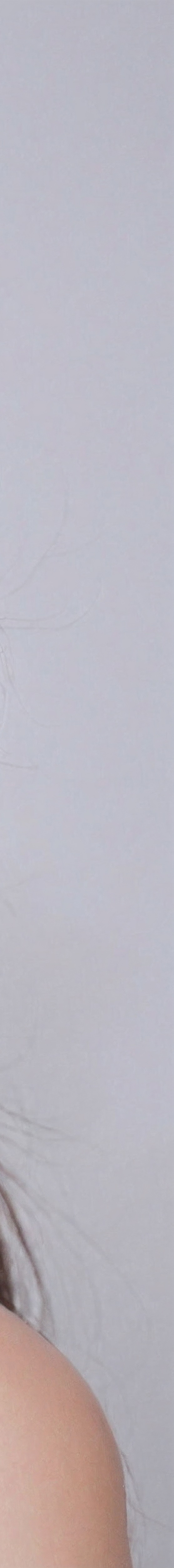 강남구무삭제라미네이트 밝은 미소 되찾기 관련 이미지 23