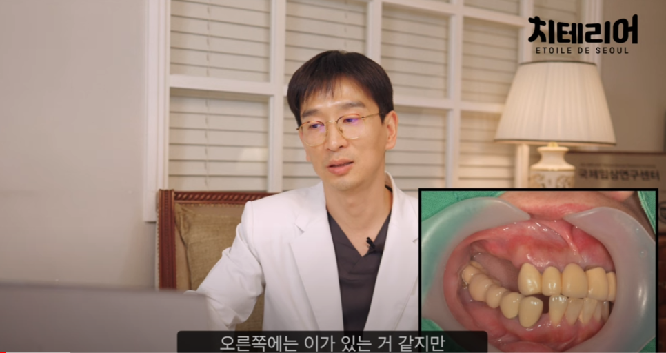 풀아치치과 임플란트 제대로 수술을 받으려면 관련 이미지 4