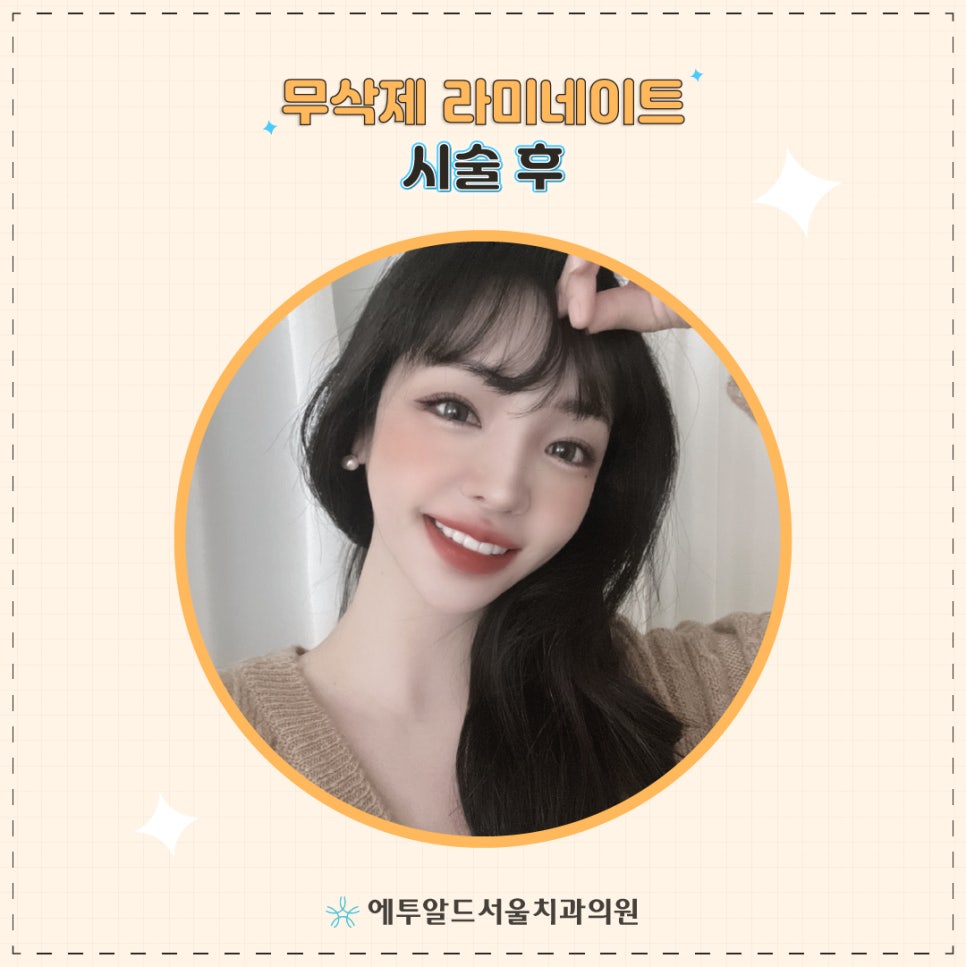 예쁜데 치아까지 예뻐 : 무삭제 라미네이트 관련 이미지 3