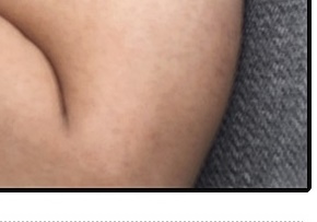 슬픈젖꼭지 증후군 진짜 있을까요? 관련 이미지 15