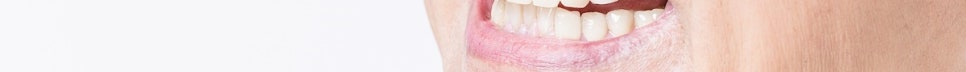 If You’re Considering Full-Arch Implant Dentures image 36
