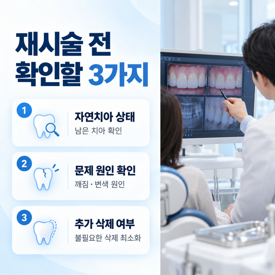 라미네이트 재시술, 떼기 전에 관련 이미지 9