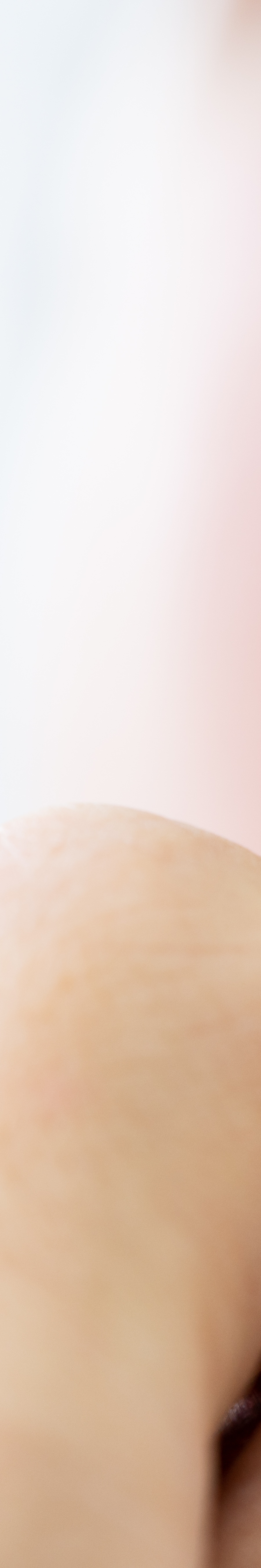 올온엑스 임플란트 과연 해결이 가능할까 관련 이미지 29