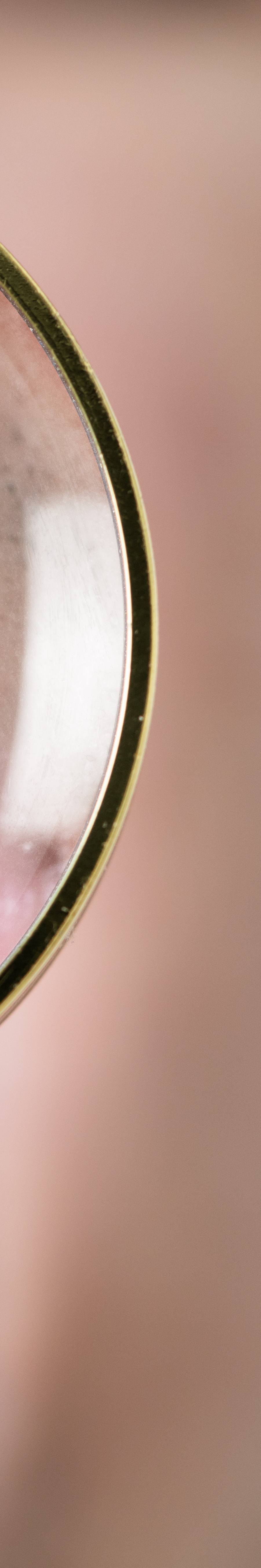 올온엑스 임플란트 과연 해결이 가능할까 관련 이미지 36