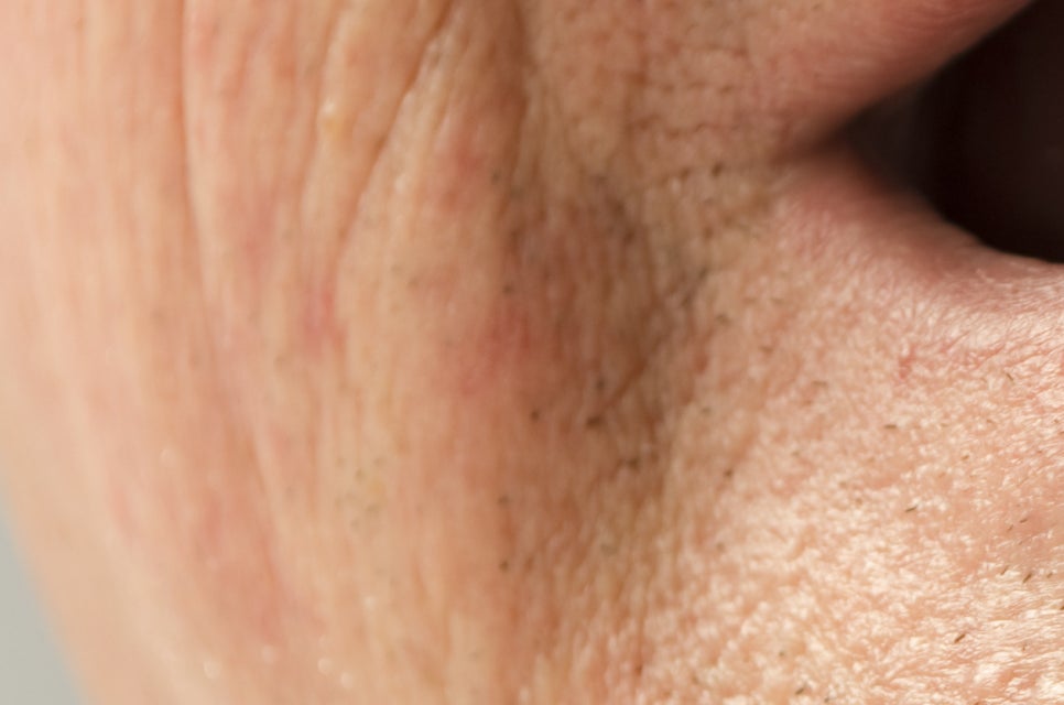 압구정로데오역 치과 불편한 틀니 대신 풀아치 임플란트! 관련 이미지 22