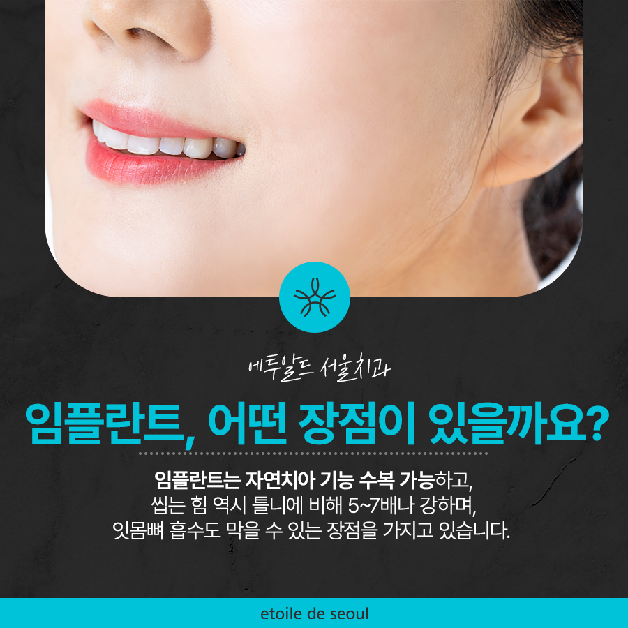 강남 65세이상임플란트 이것만 참고하자! 관련 이미지 3