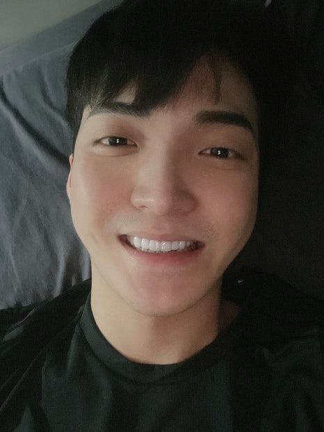 Worried That Apgujeong Veneers Might Be Too White? image 4