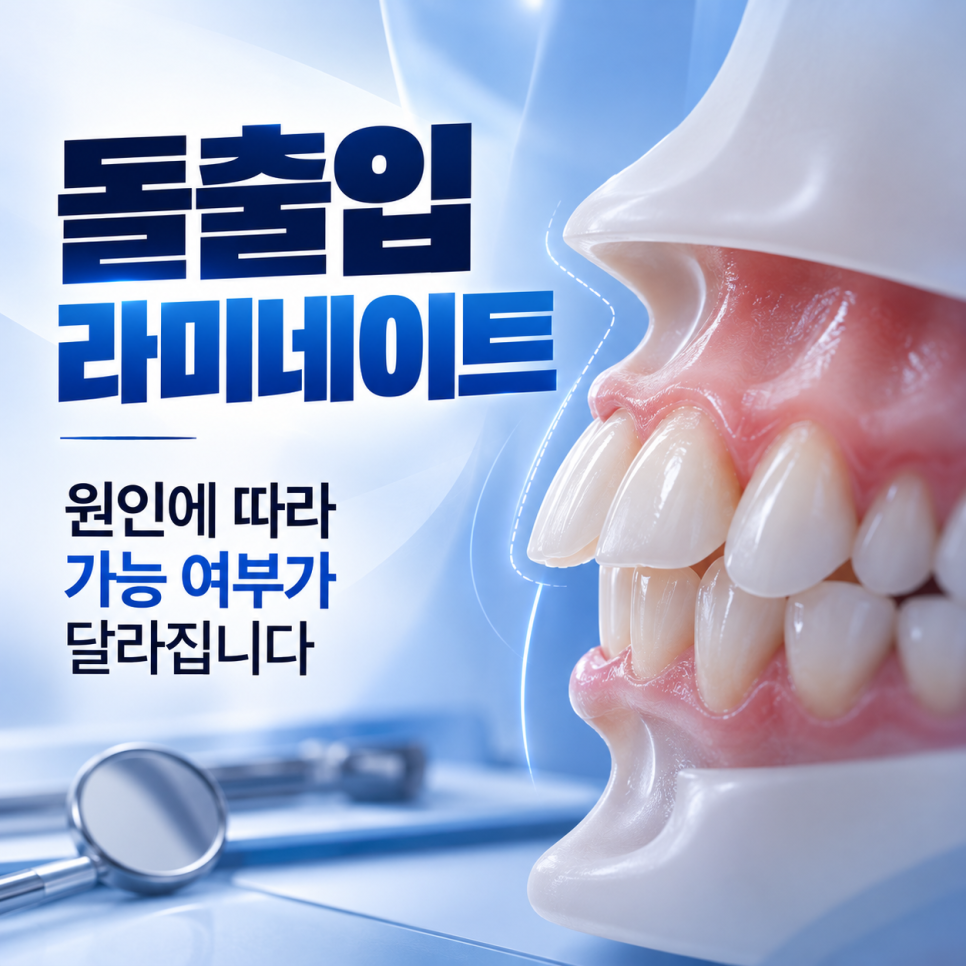 돌출입 라미네이트 가능할까요? 원인부터 짚어보면 [압구정치과] 관련 이미지 2