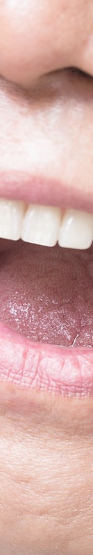 압구정치과 풀아치임플란트 회복기간 얼마나 필요할까 관련 이미지 36