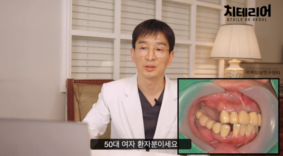 풀아치치과 임플란트 제대로 수술을 받으려면 관련 이미지 2