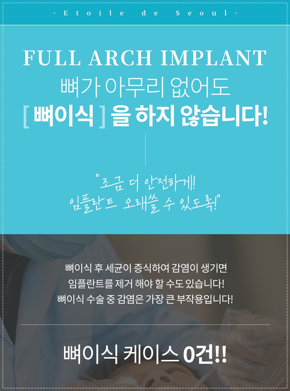 치아 삭제 없는 라미네이트 어떤 사람한테 적용 가능할까 관련 이미지 9