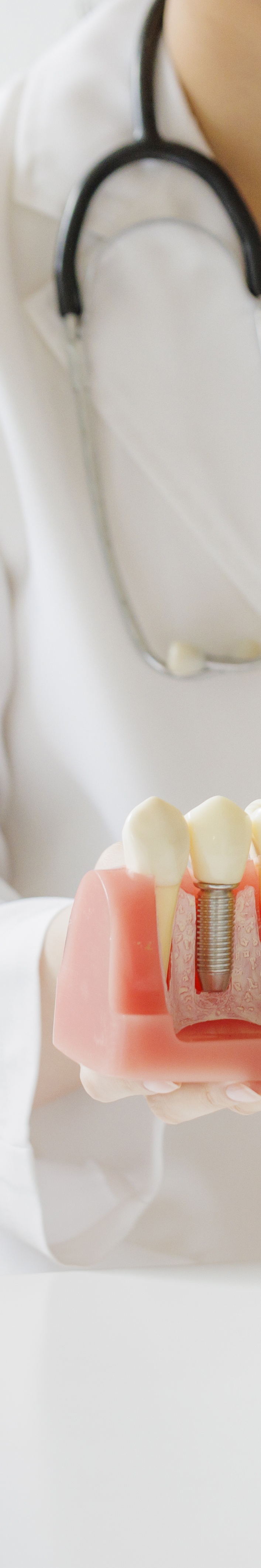 압구정 전체임플란트비용 선택 기준 7가지 살펴보기 관련 이미지 28