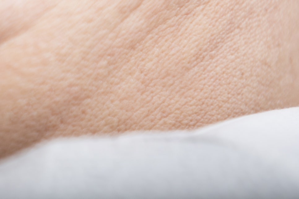 청담동 임플란트 불편함을 줄인 방법 관련 이미지 26