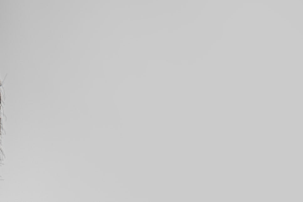 강남구 임플란트 세 가지 체크하고 결정하자! 관련 이미지 9