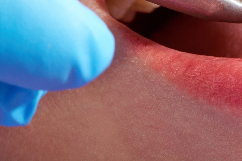 학동사거리 전악임플란트 치과 선택 시 이건 알아두자 관련 이미지 16