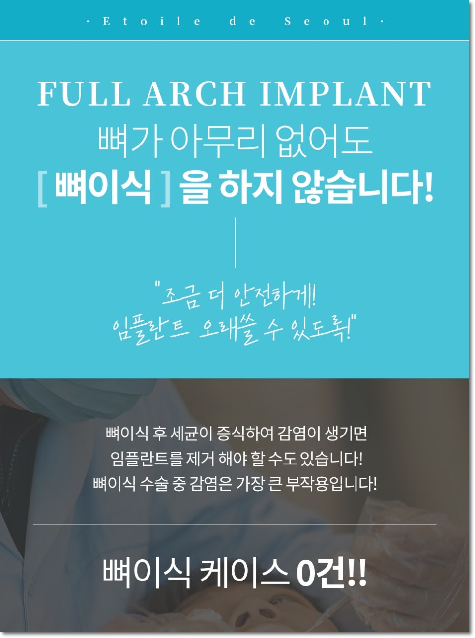 틀니 말고 다른 방법 없을까? 풀아치 임플란트 단점까지 알고 결정해야 하는 이유 관련 이미지 4