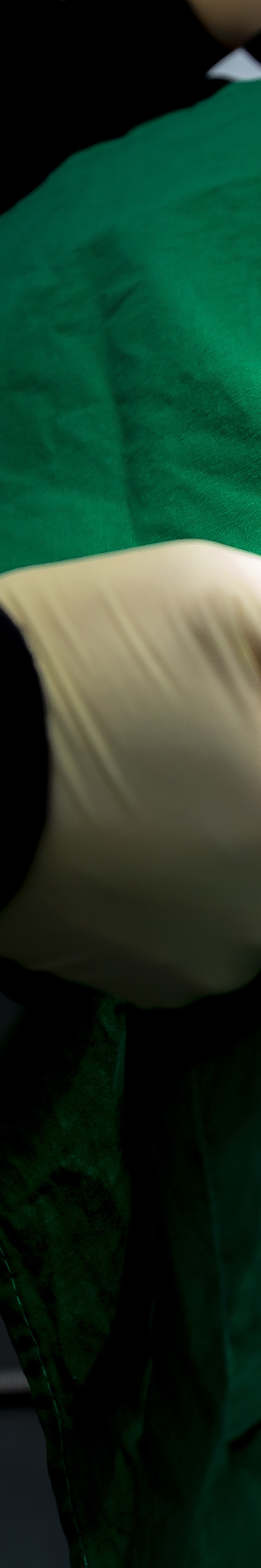 아랫니 라미네이트 숨겨왔던 미소를 되찾는 여정 관련 이미지 16