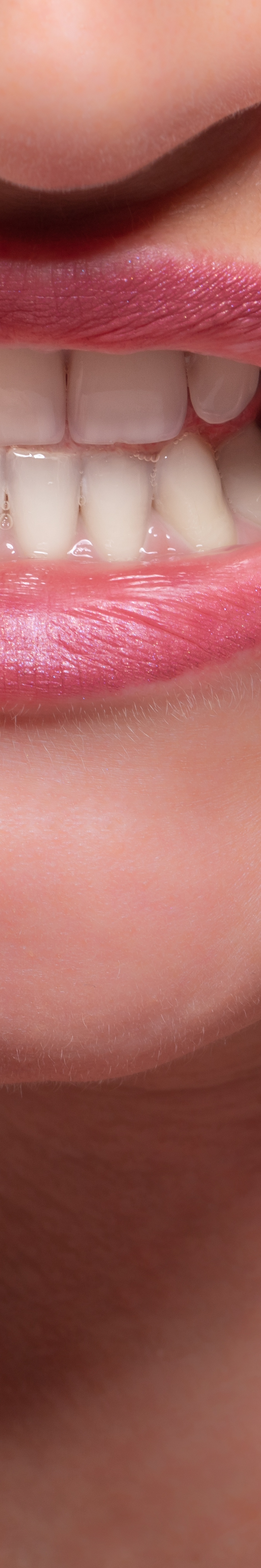 청담동치과 치아에 스트레스 받는다면 관련 이미지 25