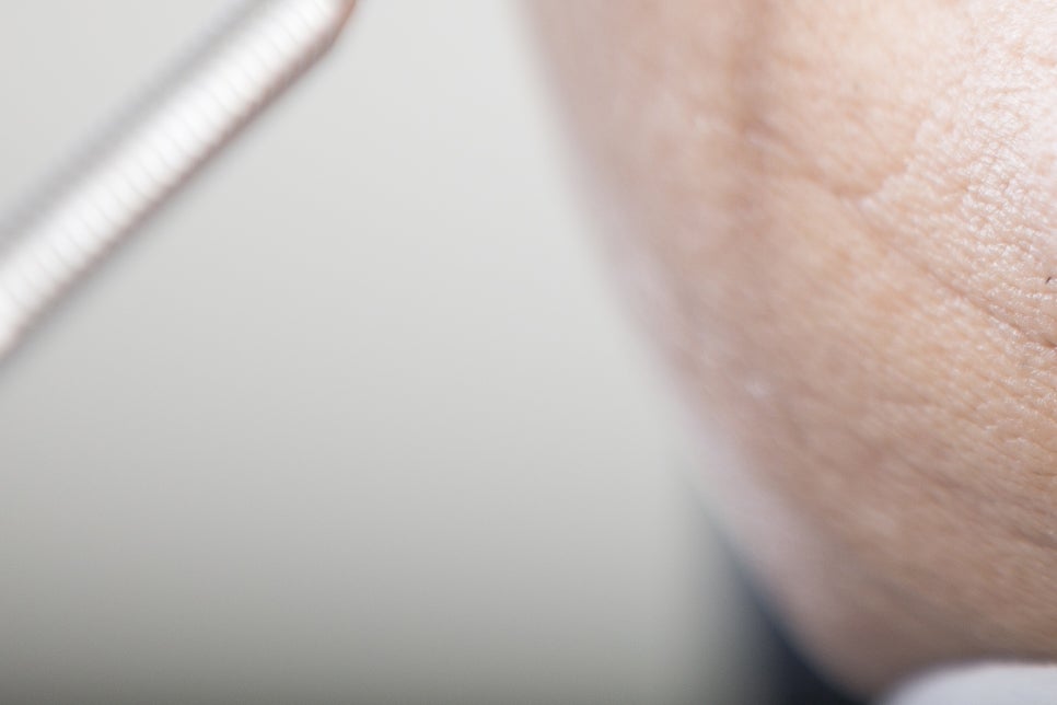 청담동 임플란트 불편함을 줄인 방법 관련 이미지 24