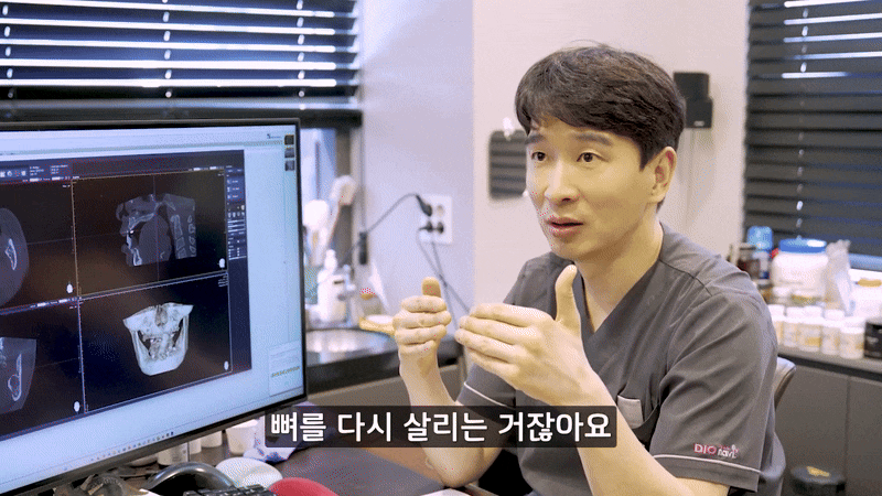 풍치 예방 방법 건강한 잇몸을 지키는 것 관련 이미지 7