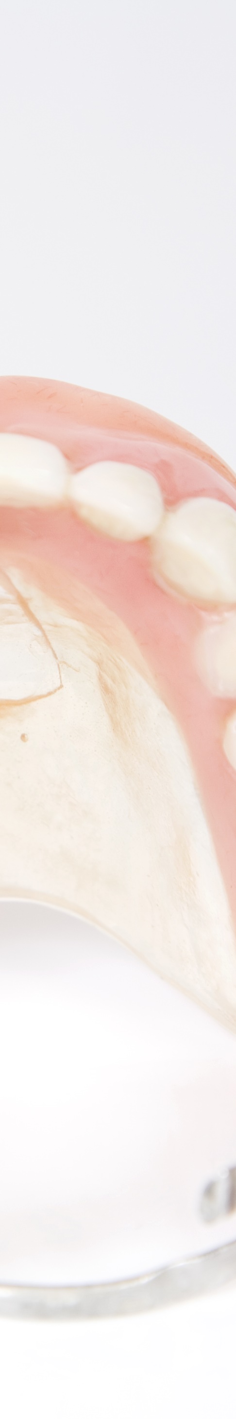 임플란트임시틀니 착용 기간과 교체 시기 관련 이미지 20