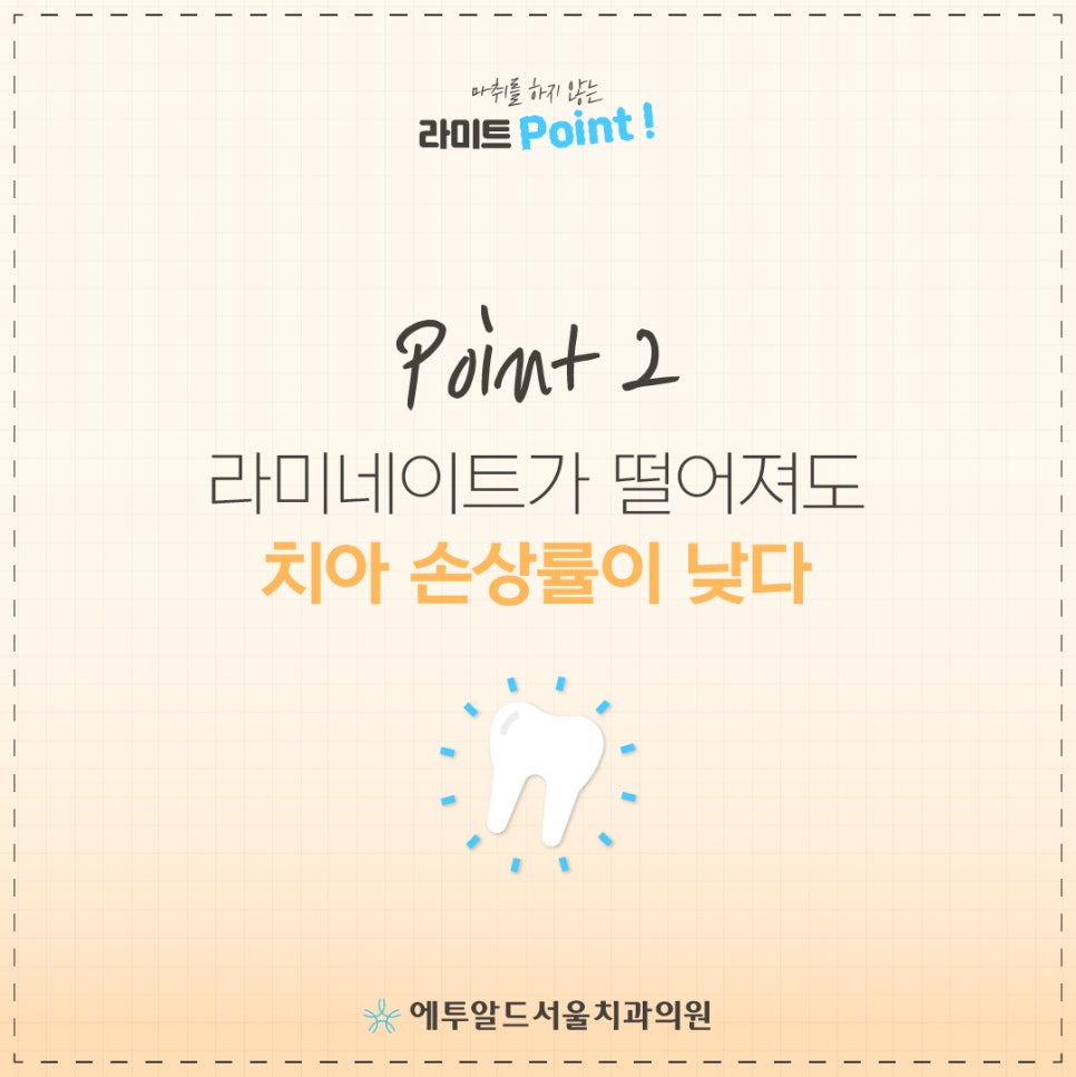 무마취 라미네이트 이거 알았으면 벌써 했지! 관련 이미지 3