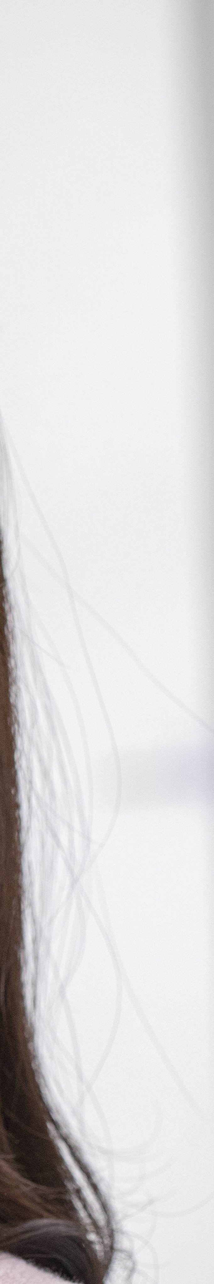 아랫니 라미네이트 숨겨왔던 미소를 되찾는 여정 관련 이미지 31