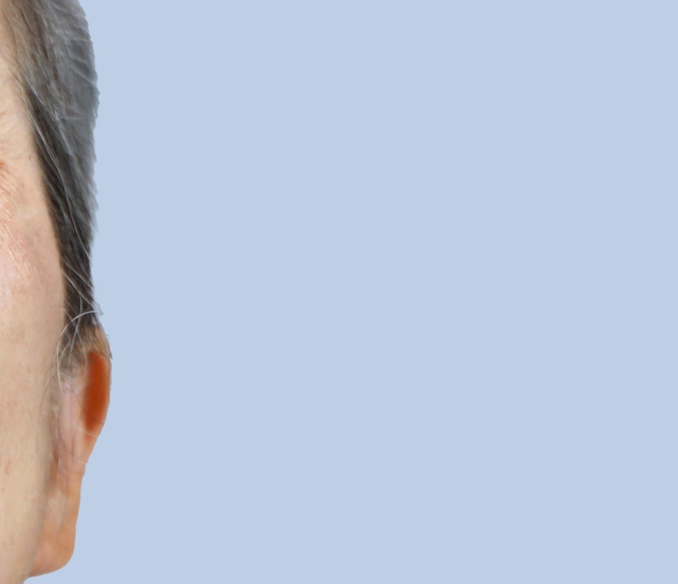 역류성식도염 목이물감 가래 낀 느낌이 느껴지나요? 관련 이미지 18