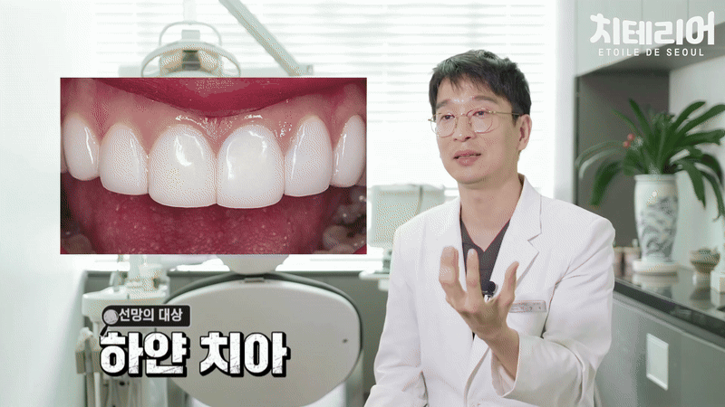청담 앞니 라미네이트 가격 싸다고 덥석 정하면 후회합니다 관련 이미지 5