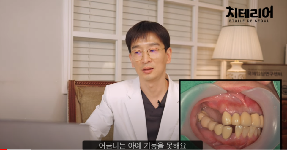 풀아치치과 임플란트 제대로 수술을 받으려면 관련 이미지 5