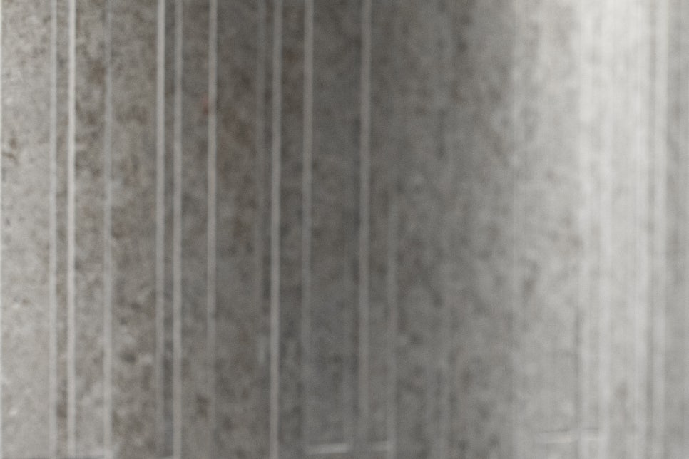 청담동 임플란트 불편함을 줄인 방법 관련 이미지 9