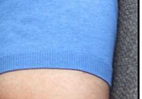 슬픈젖꼭지 증후군 진짜 있을까요? 관련 이미지 12