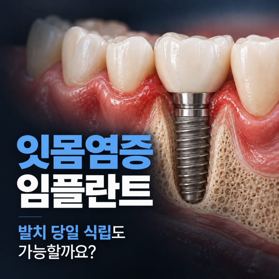 잇몸 염증 임플란트, 바로 심을 수 있을까요? 염증부터 치료해야 하는 경우 관련 이미지 2