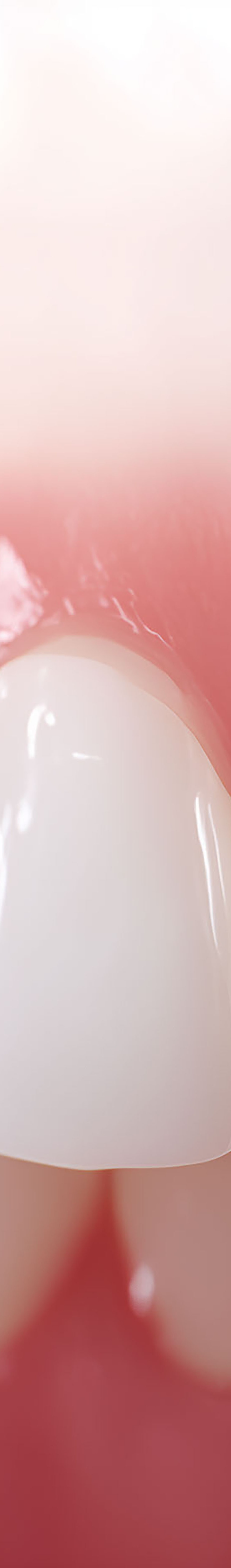 압구정로데오치과 라미네이트 어떤 포인트를 체크해야 할까 관련 이미지 22