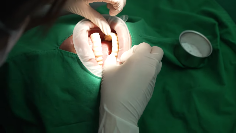 앞니임플란트잘하는곳 당신의 웃음을 찾아드립니다 관련 이미지 3