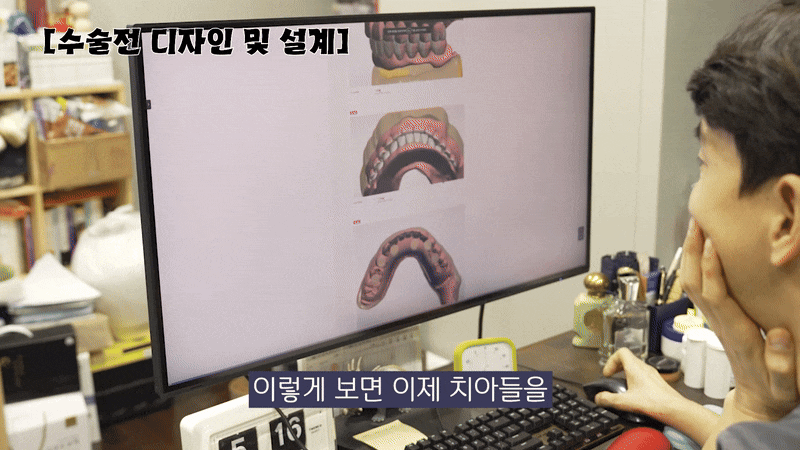 디지털 풀아치임플란트가격 노본아치로 선택 관련 이미지 8