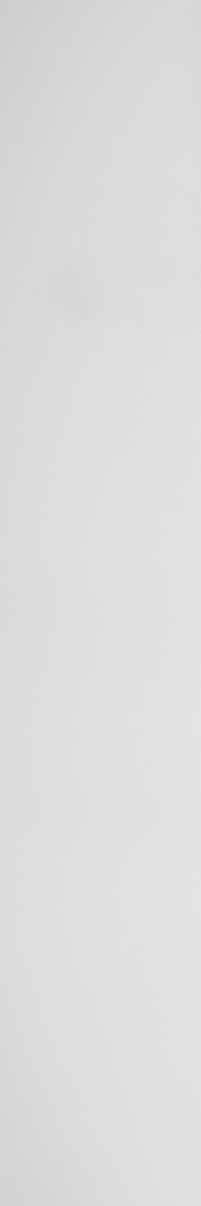 아랫니 라미네이트 숨겨왔던 미소를 되찾는 여정 관련 이미지 23