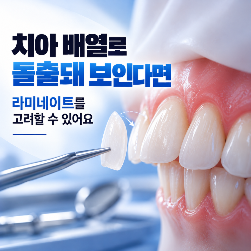 돌출입 라미네이트 가능할까요? 원인부터 짚어보면 [압구정치과] 관련 이미지 4