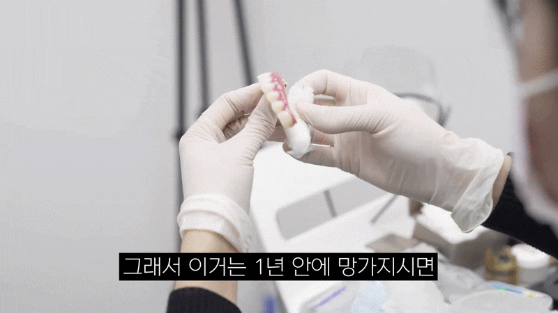 무치악 틀니 대신 가능한 풀아치 임플란트 관련 이미지 13