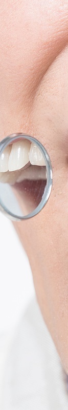 압구정치과 풀아치임플란트 회복기간 얼마나 필요할까 관련 이미지 34