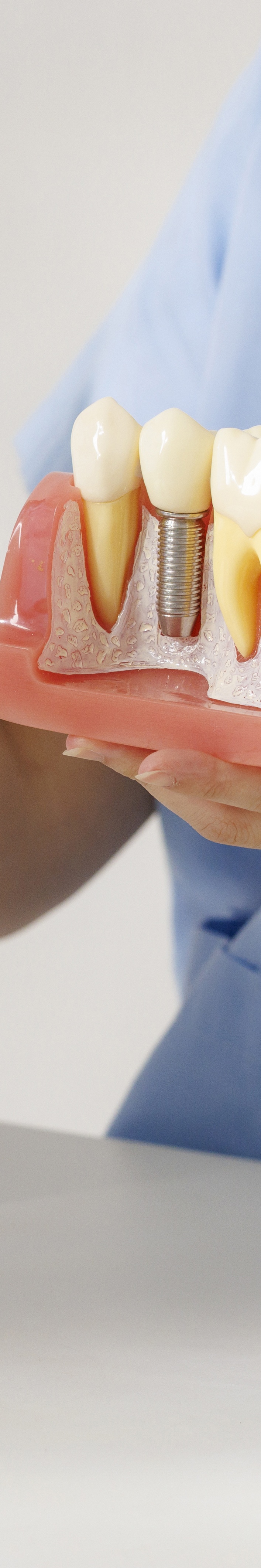 압구정 전체임플란트비용 선택 기준 7가지 살펴보기 관련 이미지 23