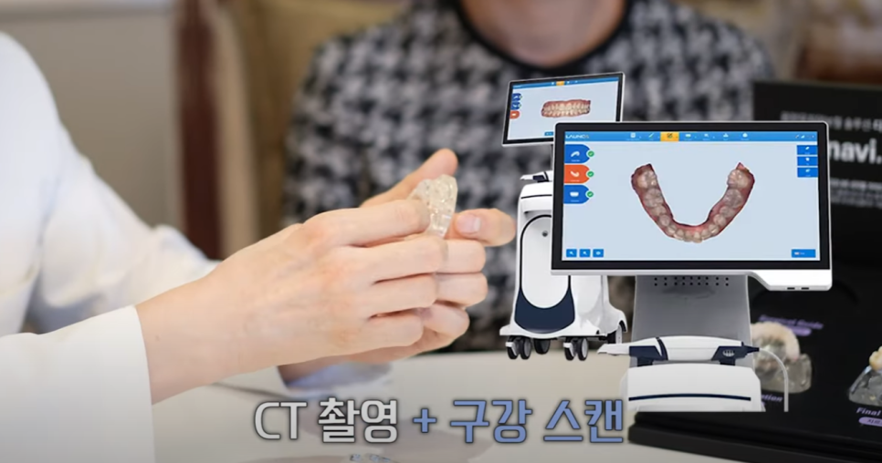 디오나비풀아치 무치악으로 고통받지 않도록! 관련 이미지 4