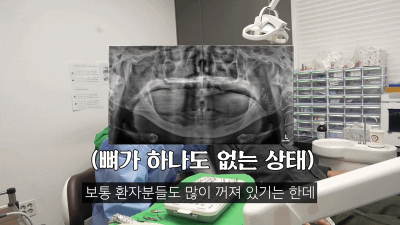 풀아치 임플란트 통증 걱정 때문에 망설이셨다면 치료 전에 알아야 할 5가지 관련 이미지 7