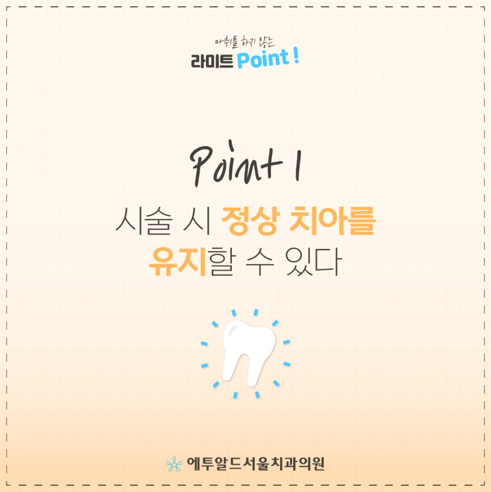 무마취 라미네이트 이거 알았으면 벌써 했지! 관련 이미지 2