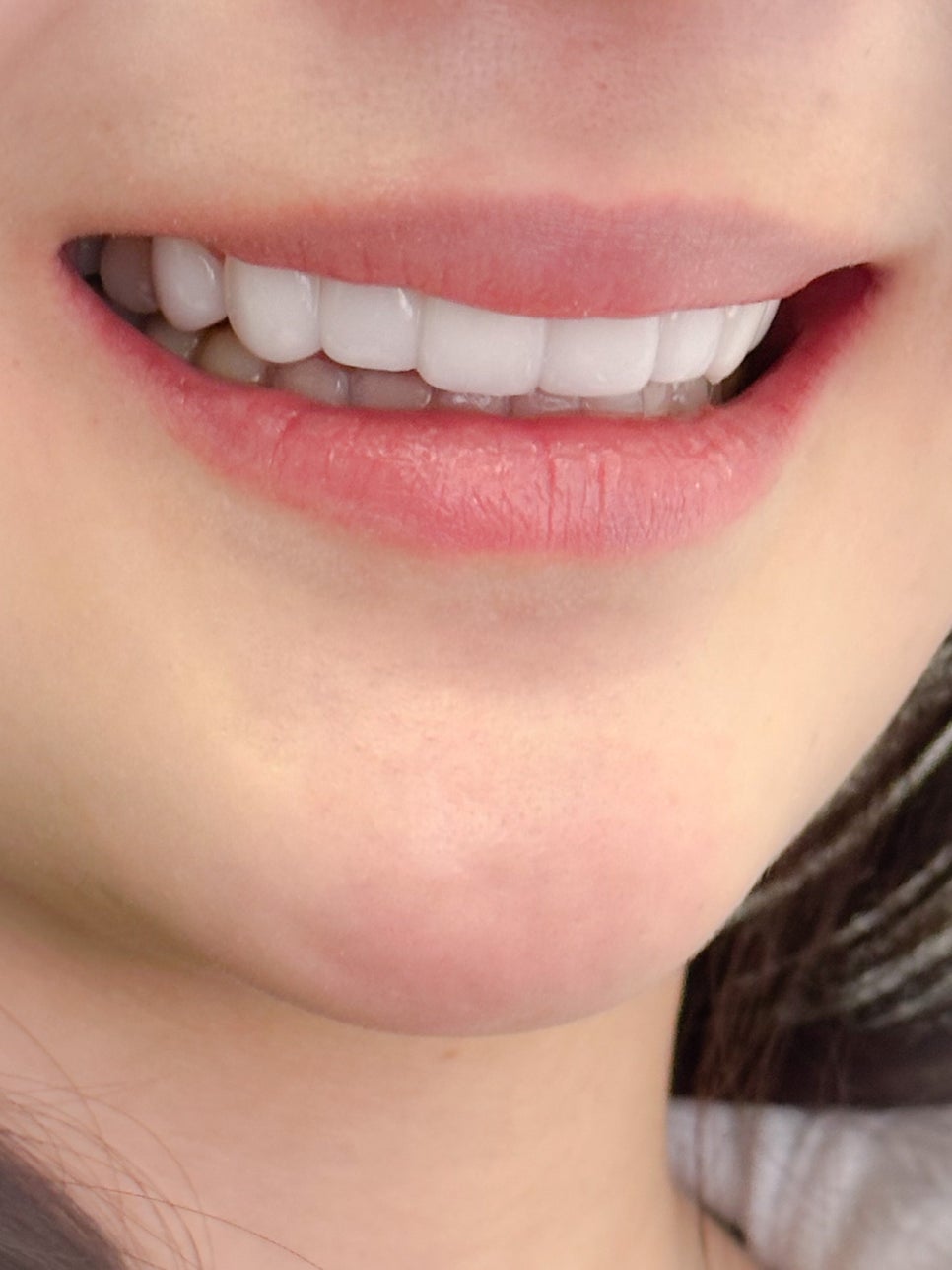 라미네이트 종류 비교 비용과 과정까지 안내 관련 이미지 3